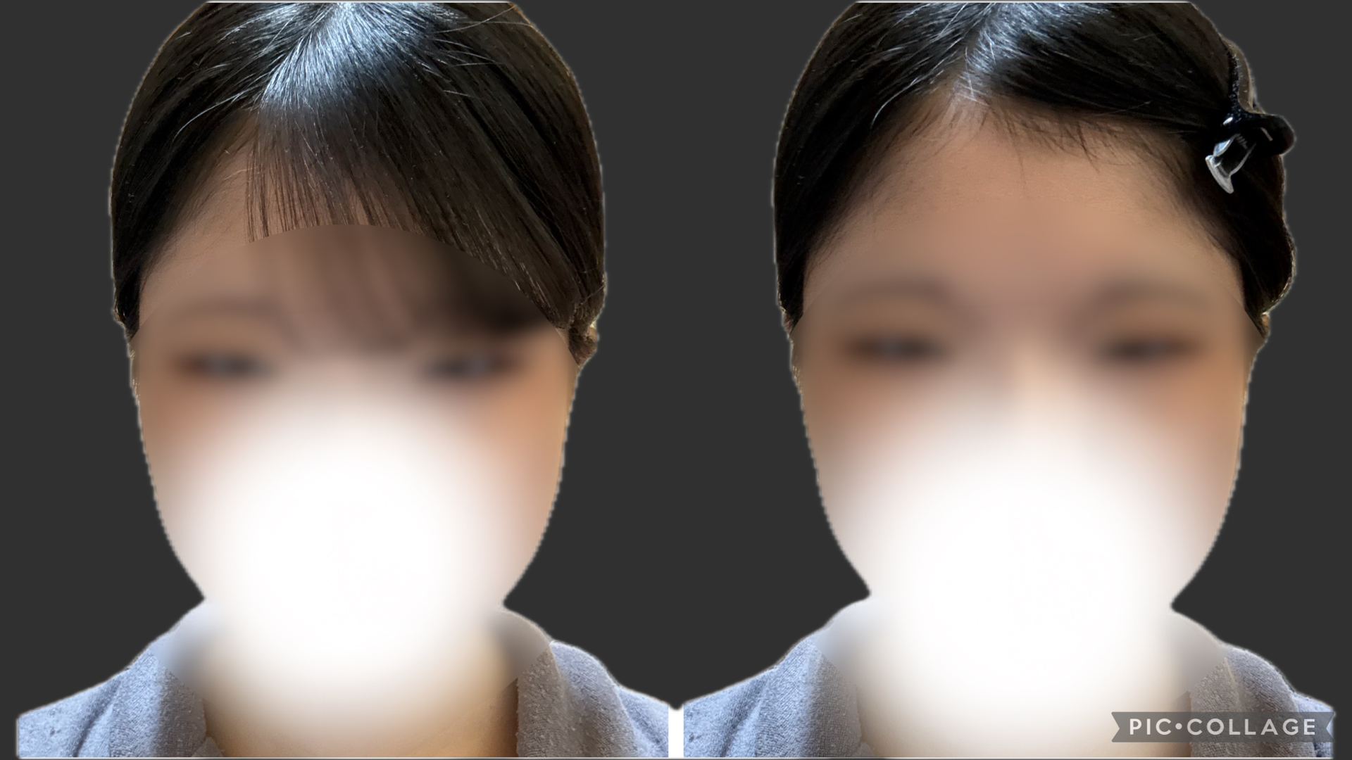 スレッドヘッダー画像: 普通に止め方がおかしいけど前髪あるの都内のどっちのほうがよさそう？