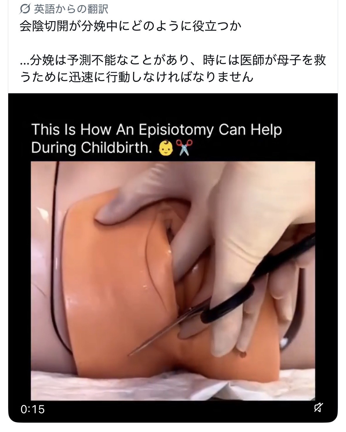 スレッドヘッダー画像: 会陰切開っておしりの穴に向かって縦に切るんかと思ってたけどまさかの斜め横なの…？エグすぎる