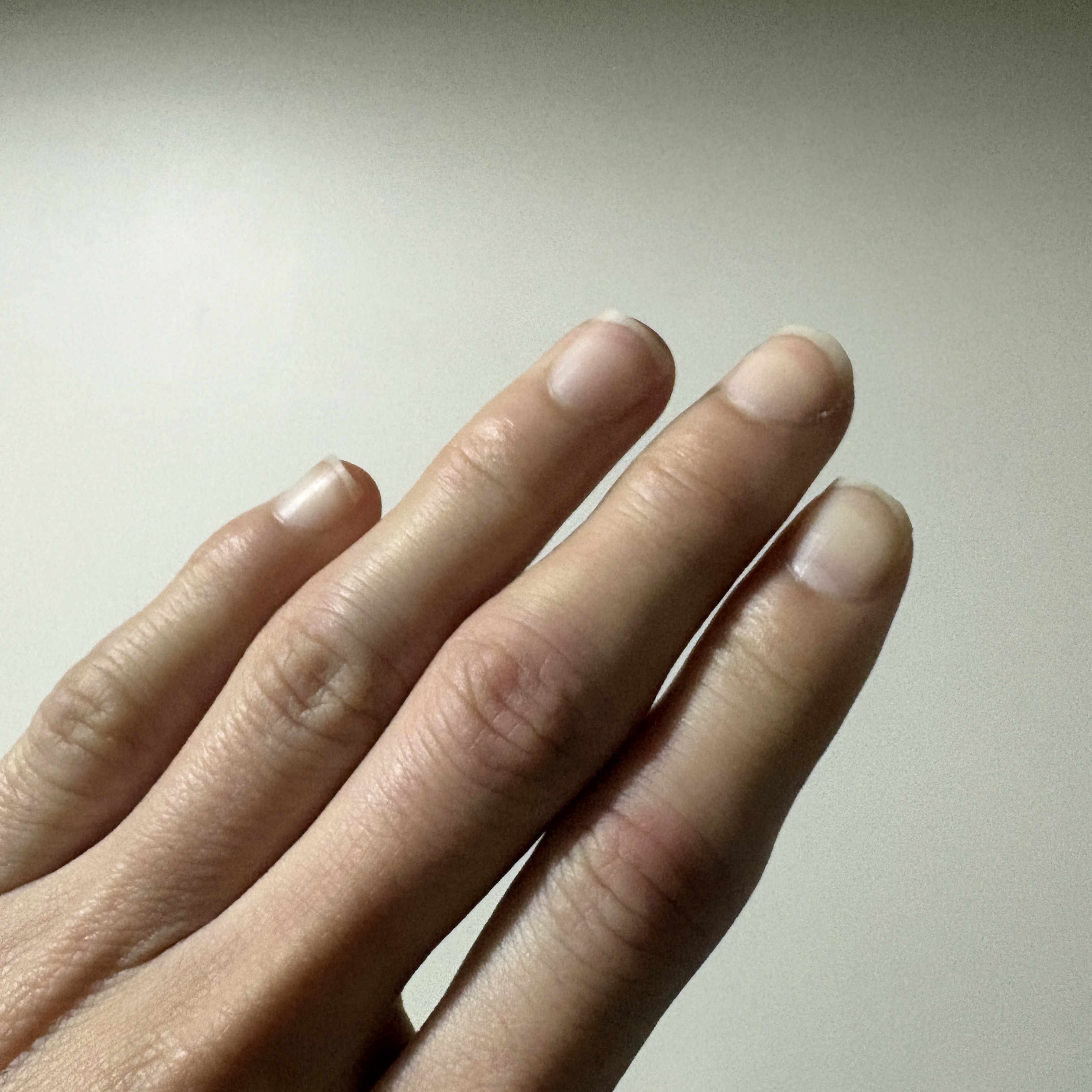 スレッドヘッダー画像: やっぱまだ指痛いなー。
なんだろう、こたつで温まると痛くなってくるからしもやけ？