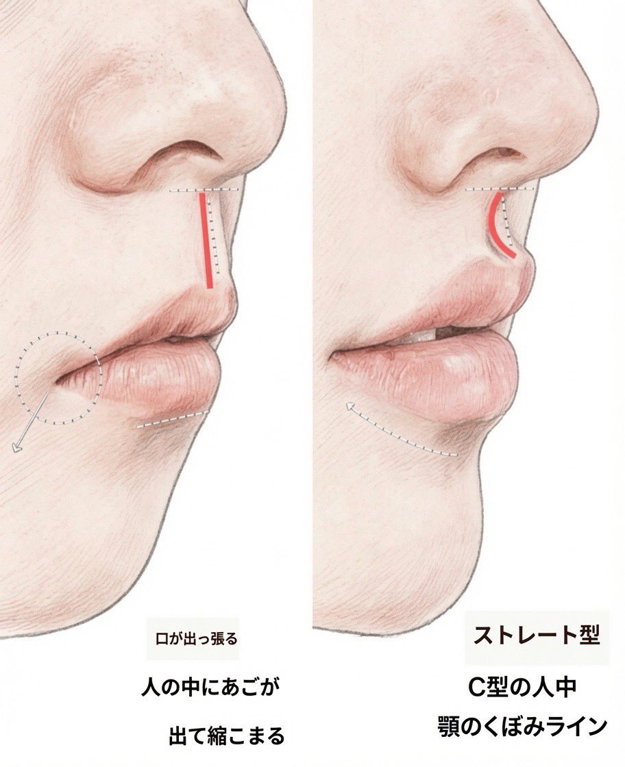 スレッドヘッダー画像: ルッキズムくそ 俺は左側ですがなにか