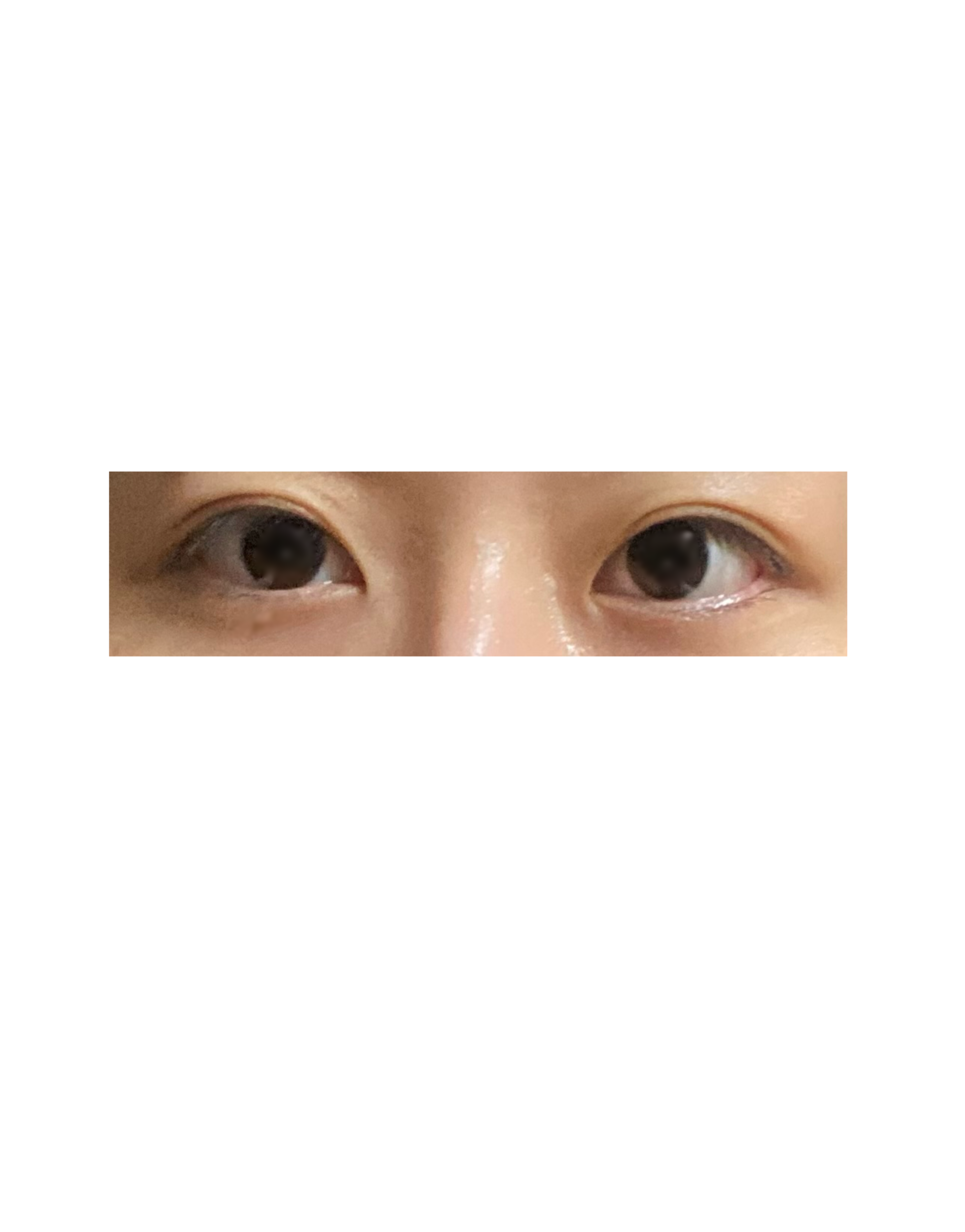 スレッドヘッダー画像: 偽斜視でしょうか？