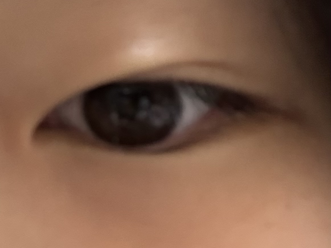 スレッドヘッダー画像: 白目むきながら目開けたら一瞬線つけれるんだけどギリ眼瞼下垂じゃないんかな、だとしたら保険効かず高い金払って整形するしかなくなるんだけど　バイトがんばろ