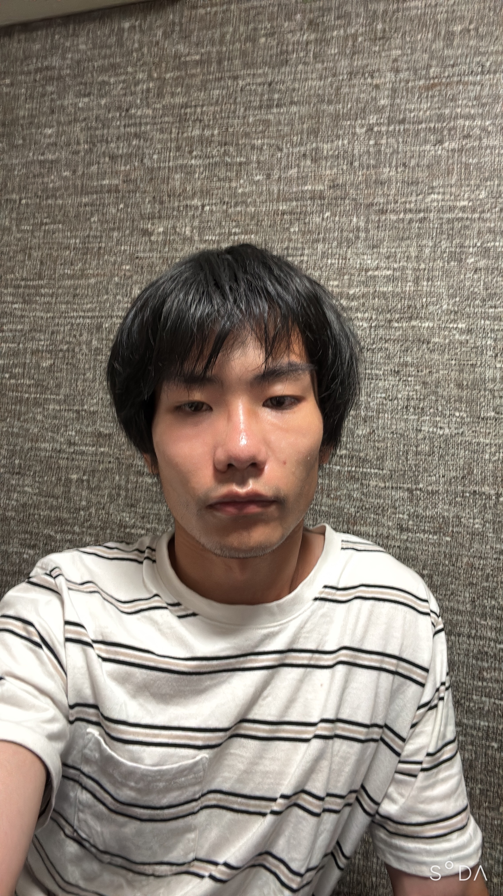 スレッドヘッダー画像: 顔にシミが出来た
グループホーム男23歳