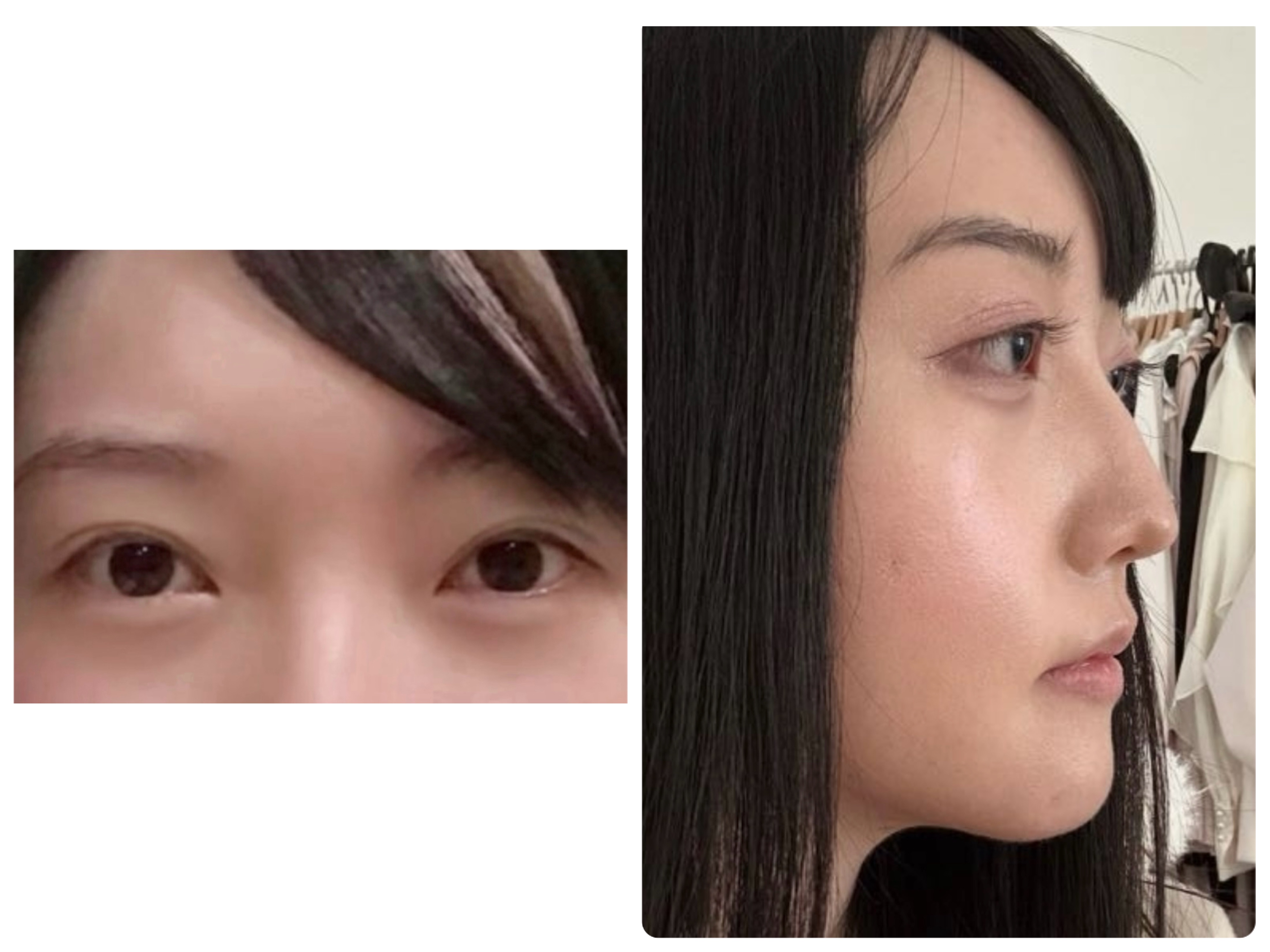 スレッドヘッダー画像: すっぴん正面　横顔
勝ちですわ〜
